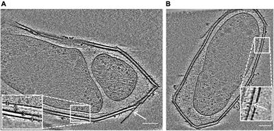 The Polygonal Cell Shape and Surface Protein Layer of Anaerobic Methane-Oxidizing Methylomirabilislanthanidiphila Bacteria